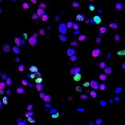 PAX8 Antibody (1F8-3A8), Novus Biologicals 100 &mu;g | Buy Online | Novus Biologicals | Fisher Scientific